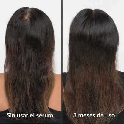 Serum Capilar